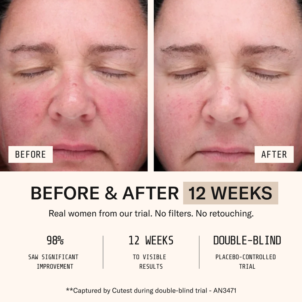 Collagen+
