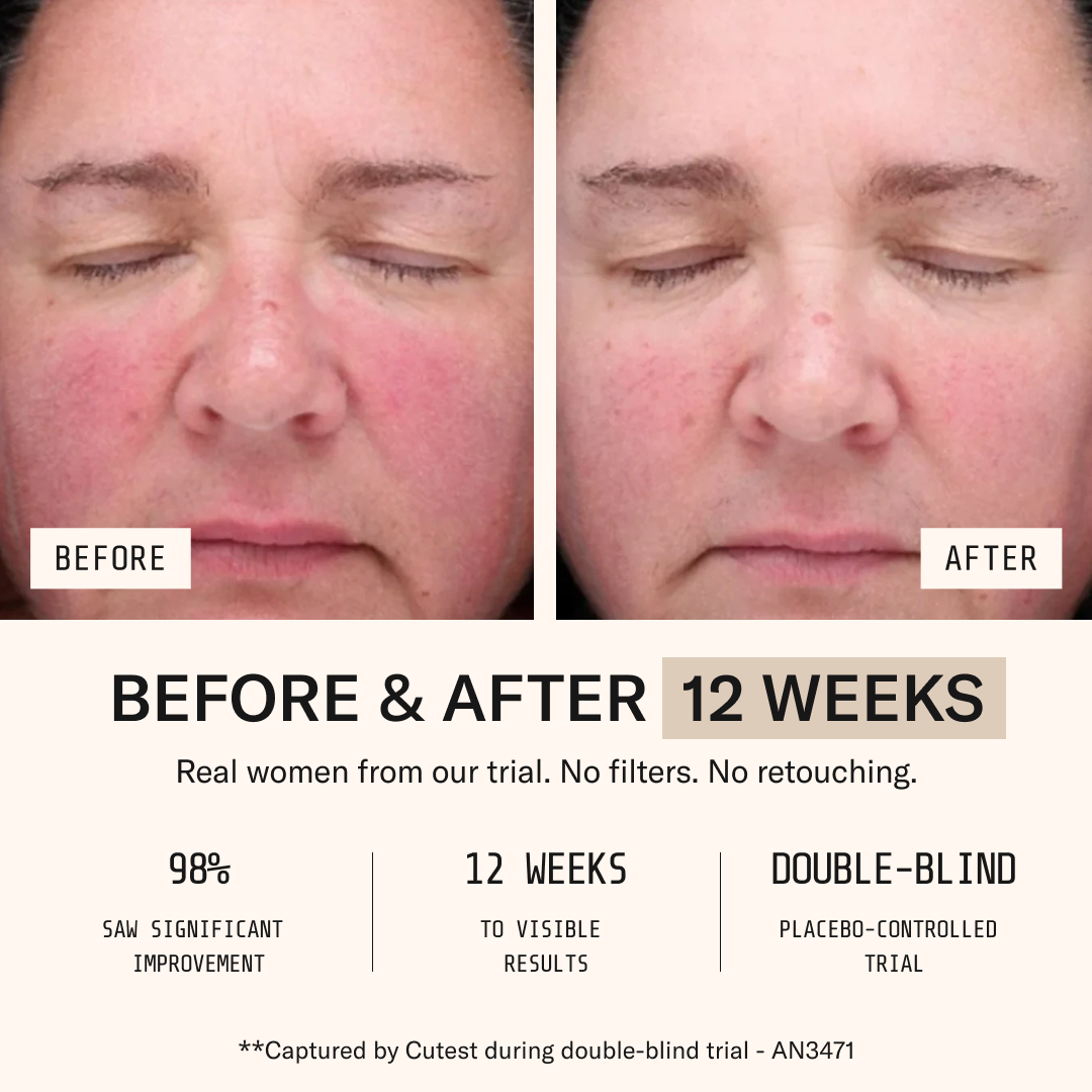 Collagen+