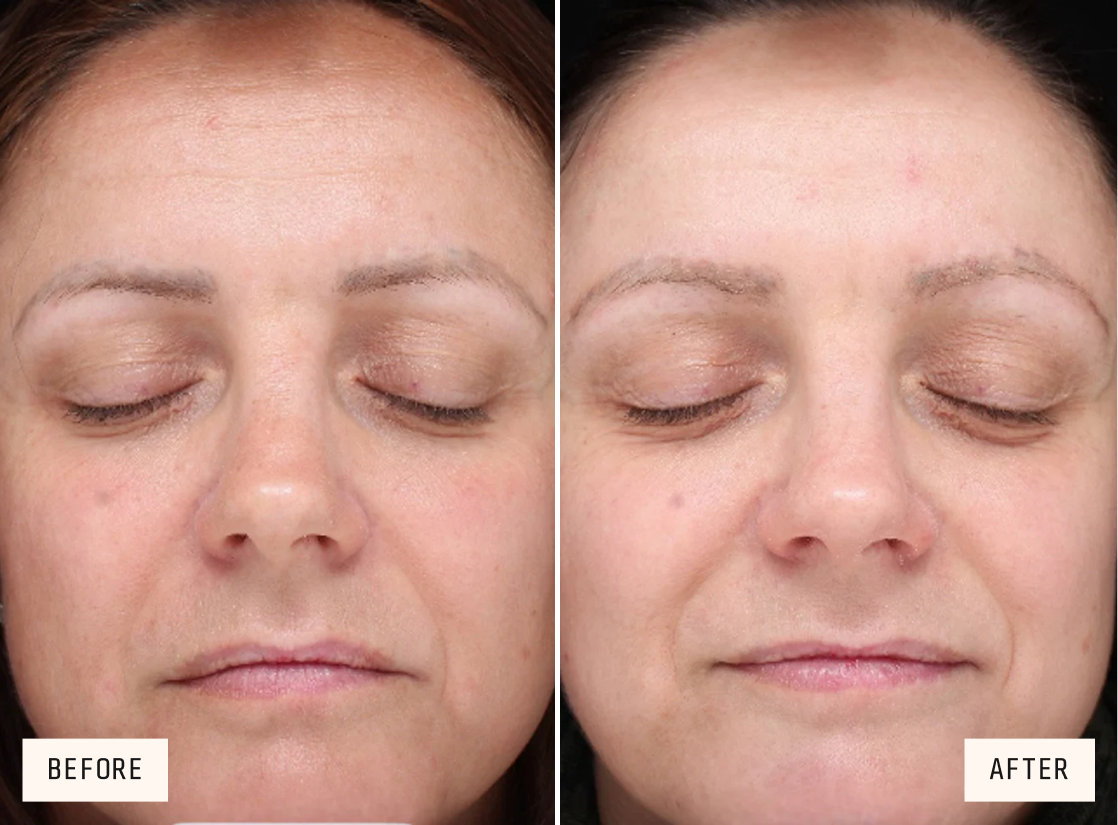 Product Trial Image
