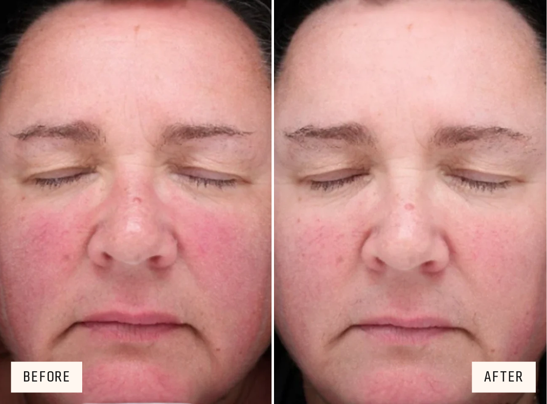 Product Trial Image
